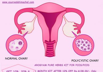 This Festival Season Treat PCOS/PCOD with Arogyam