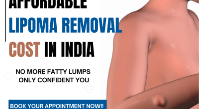 Lipoma Removal Treatment in Delhi