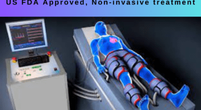 EECP Treatment