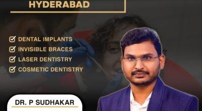 Best Dental Doctor in AS Rao Nagar