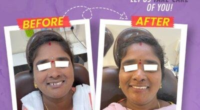 Smile Makeover: It’s Time to Love Your Smile Again