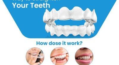 Fix your Smile with Invisalign Aligners