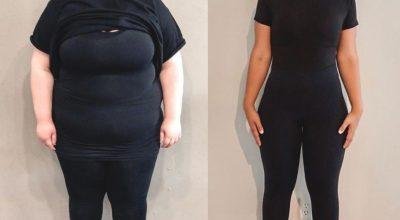 Attain Top Weight Loss Clinic in Delhi:Myo Clinix