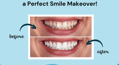 Expert Dental Care in Gurugram: Visit Dr. Khullar