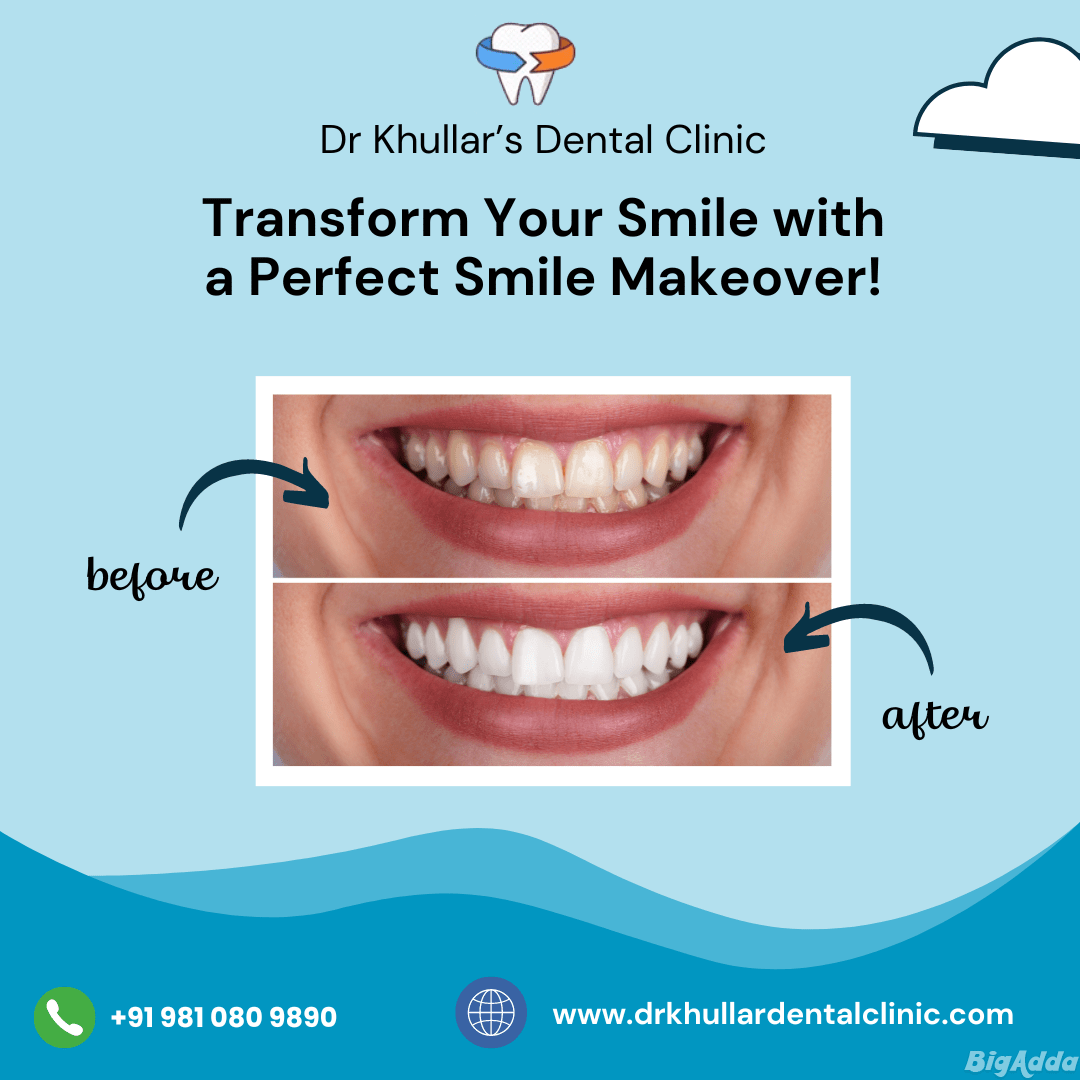 Expert Dental Care in Gurugram: Visit Dr. Khullar