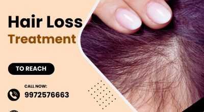 Best Hair Loss Treatment in Bangalore by Pioneer