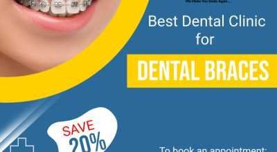 Transform Your Teeth with Top-Notch Dental Braces