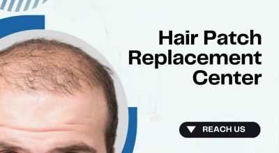 Hair Patch Repair & Replacement Center Bangalore