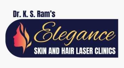 laser hair removal service in secunderabad