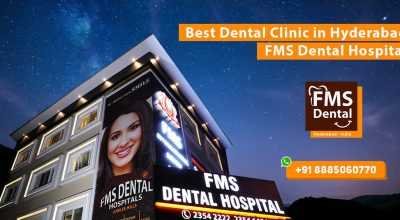 Best Dental clinic in Hyderabad – FMS Dental