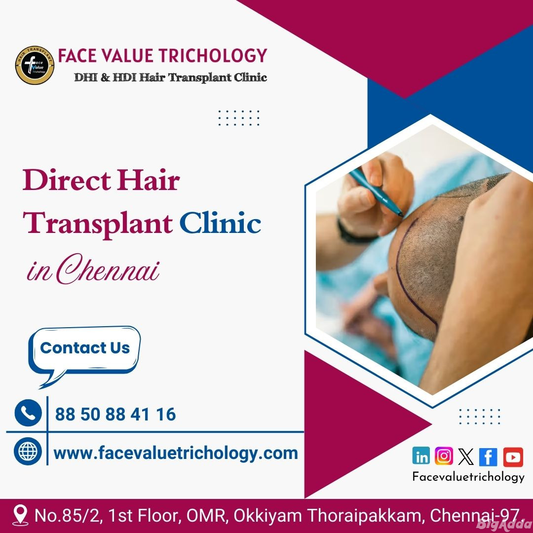 Best Direct Hair Implantation Services in Madurai
