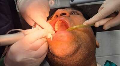 Dental Clinic in Zirakpur | AGS Dental Care