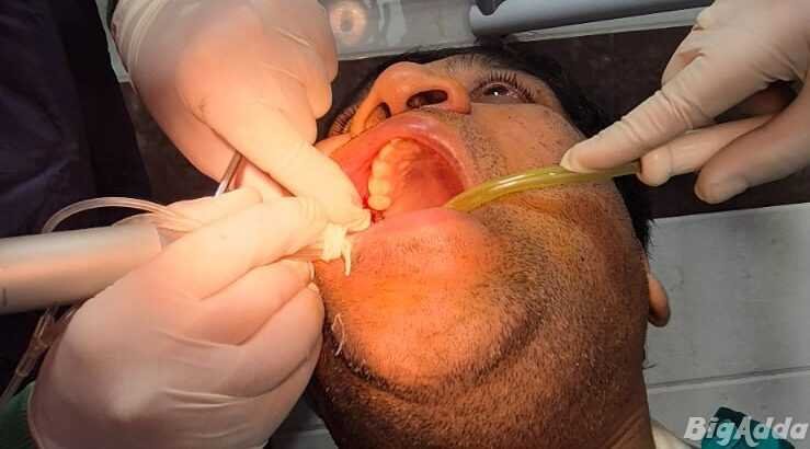 Dental Clinic in Zirakpur | AGS Dental Care