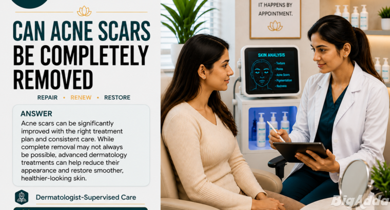 Acne Scar Treatment in balewadi