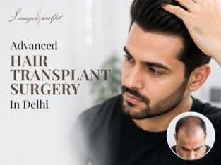 Get Hair Transplant in Delhi at Langersculpt