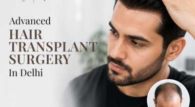 Get Hair Transplant in Delhi at Langersculpt