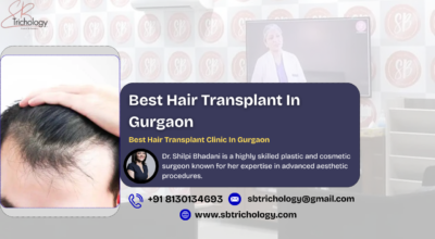 Trusted Hair Transplant Clinic in Gurgaon