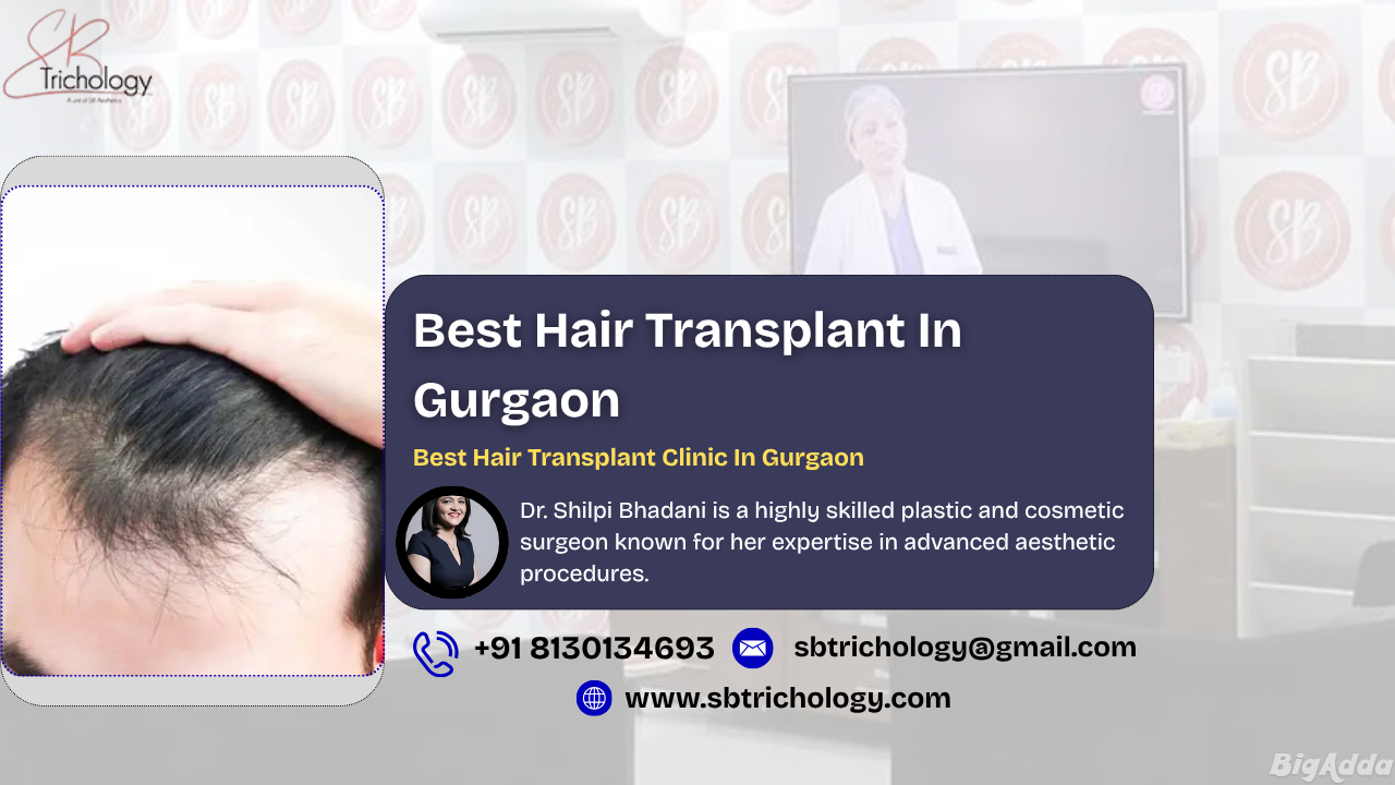 Trusted Hair Transplant Clinic in Gurgaon