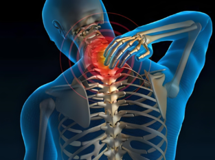 Cervical Spondylitis Treatment in Delhi NCR