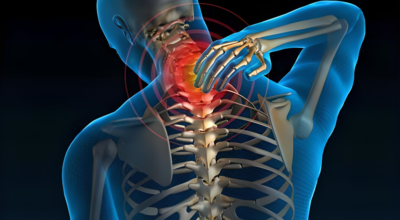 Cervical Spondylitis Treatment in Delhi NCR