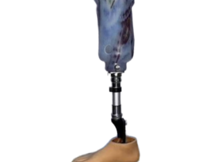 Artificial Limb Centre in Delhi