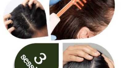 Best Anti-Dandruff clinic in India