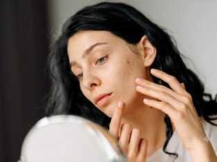 Facial Reconstructive Plastic Surgery, Coimbatore