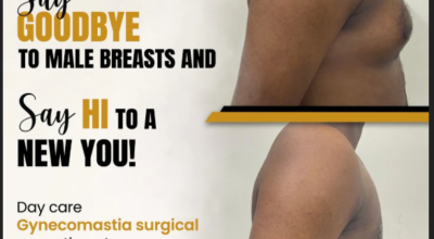 Gynecomastia Surgery in Chennai | Aesthetic Studio