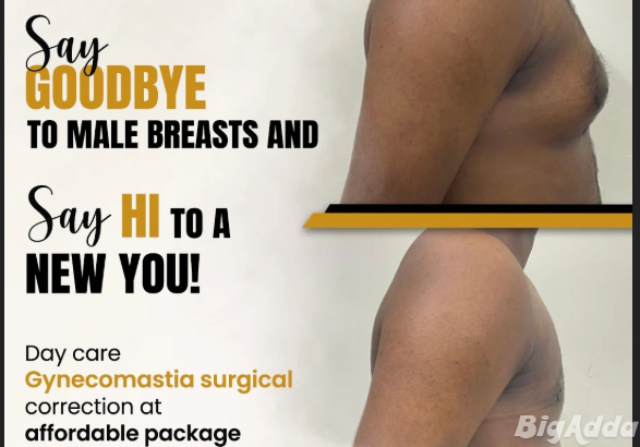 Gynecomastia Surgery in Chennai | Aesthetic Studio