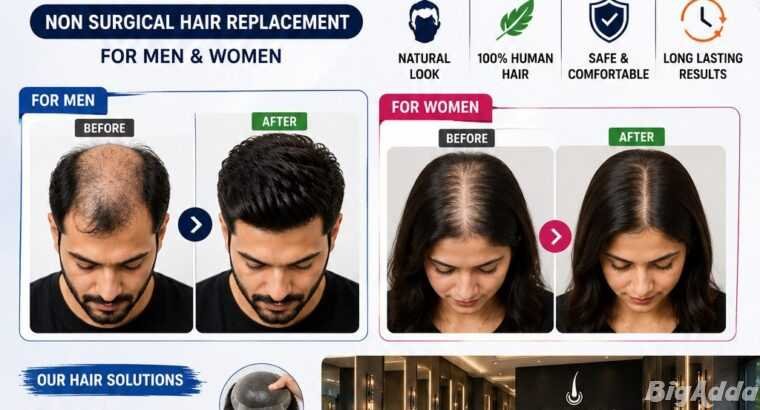 HAIR LOSS? YOUR NEW LOOK STARTS HERE!
