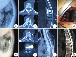 Dr Fazal Rehman -Spine Surgeon