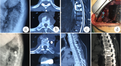 Dr Fazal Rehman -Spine Surgeon
