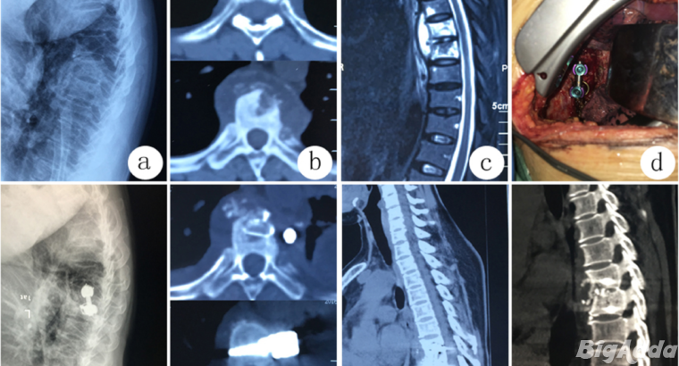 Dr Fazal Rehman -Spine Surgeon