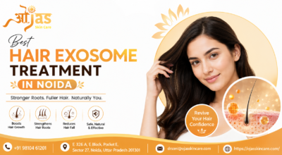 Best Hair Exosome Treatment in Noida