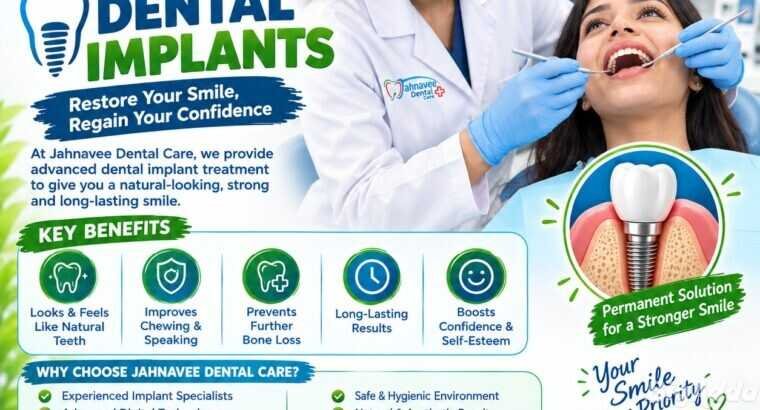 Dental Implants in Ghatlodiya – Dental Care