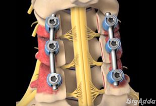 Dr Fazal Rehman -Spine Surgeon