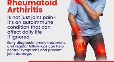 Best Rheumatology Doctor in Indore