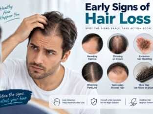 Early Signs of Hair Loss – Know the Warning Signs