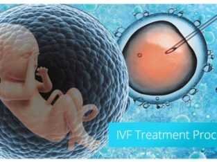 Find the best infertility doctor in Kankarbagh