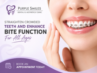 Painless Dentistry in Sector 46 Noida
