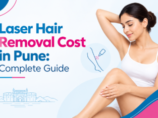 Best Laser Hair Removal Treatment in Pune – Skinov