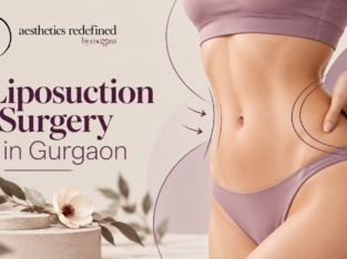 Liposuction Surgery in Gurgaon – Consultation, Ben