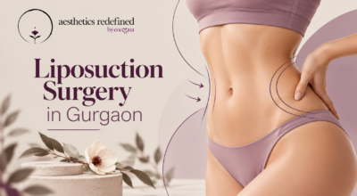 Liposuction Surgery in Gurgaon – Consultation, Ben