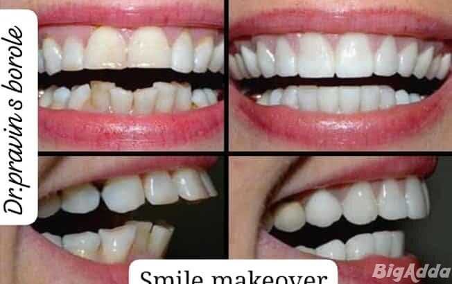 Anand Dental clinic & implant center