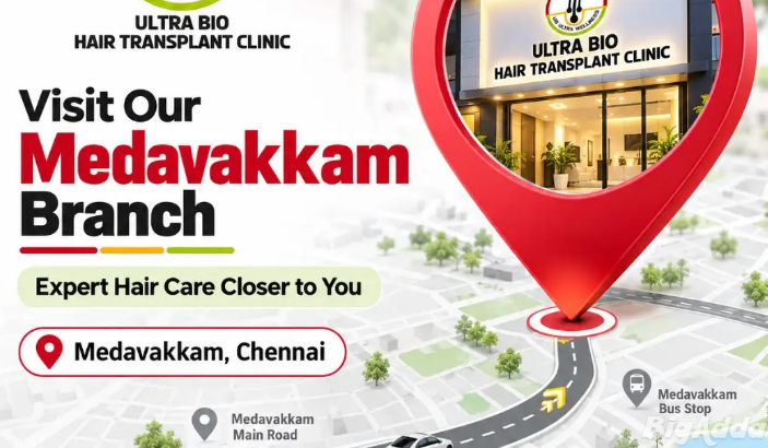 Best hair transplant in chennai
